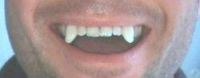 Weiterlesen: Ästhetische Zahnheilkunde / schöne Zähne